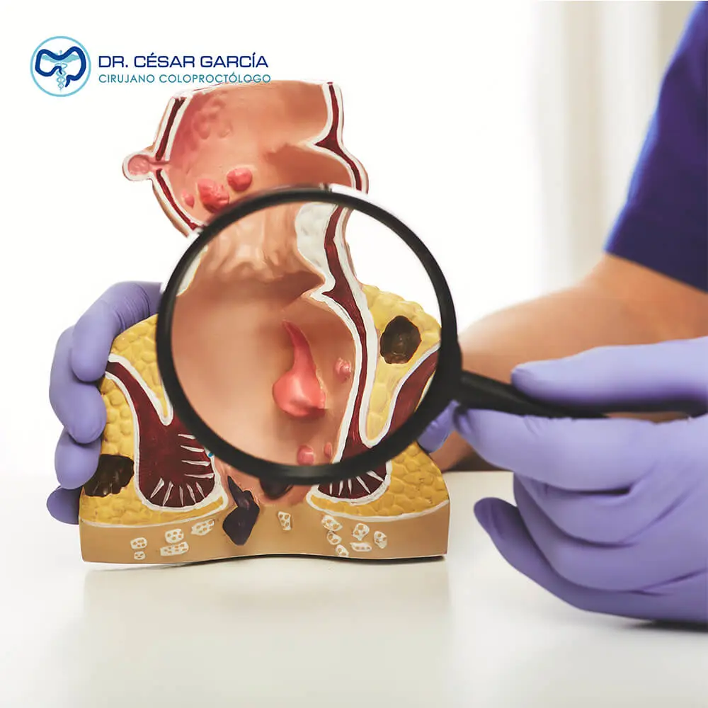 Dr. César García atendiendo pacientes en Hospital Ángeles Tampico