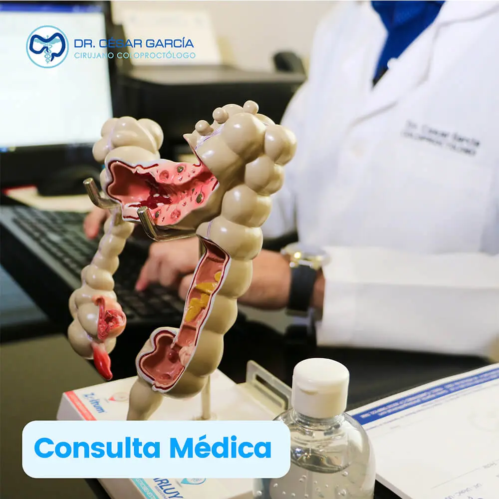 Consulta médica coloproctológica con el Dr. César García en Tampico