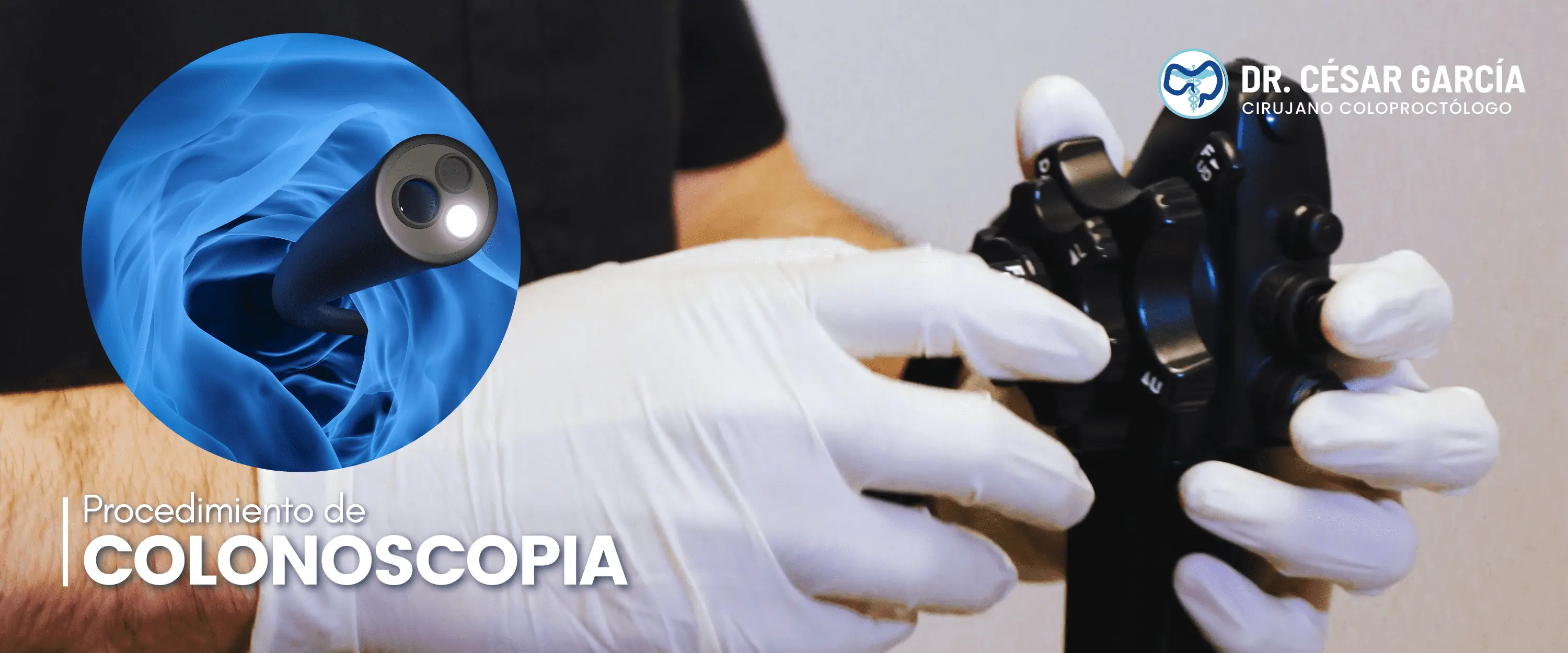 Colonoscopia y cirugía laparoscópica en Tampico - Dr. César García